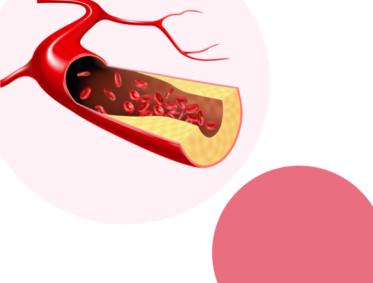 Фенофибрат — обновленное описание